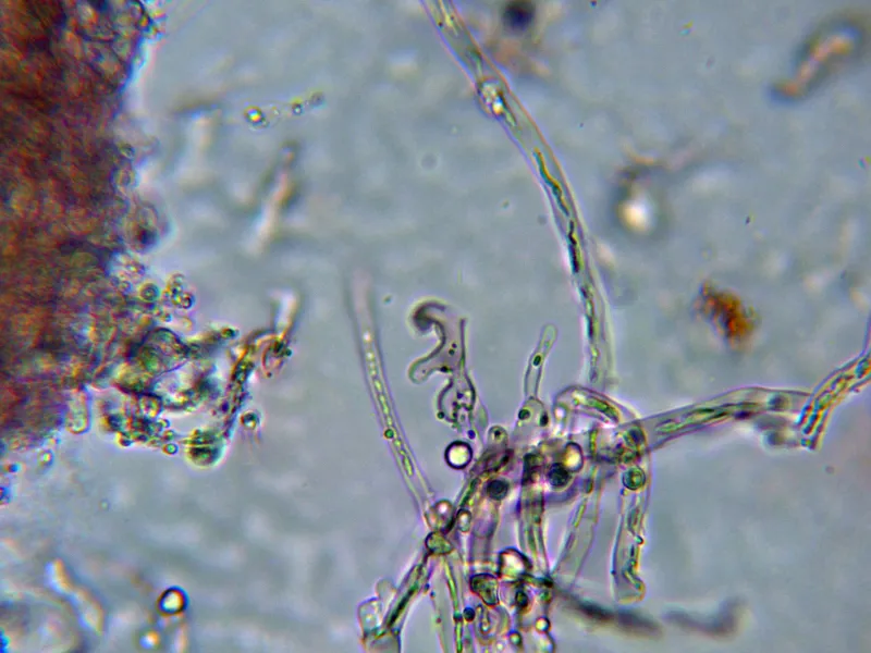 Daedalea xantha 10 - Hifa generativa fibulada apilado